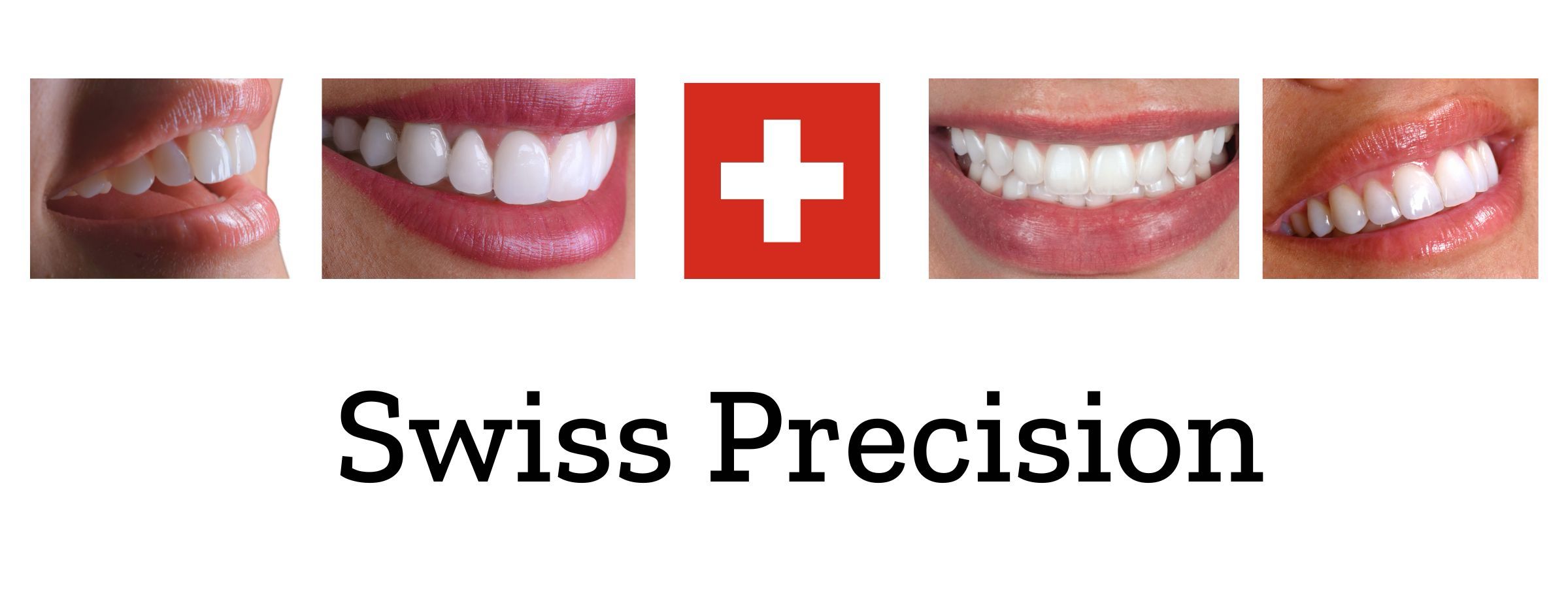 Smiling patient showcasing premium veneers treatment results in Geneva